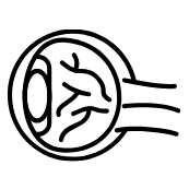 ORbit MRI