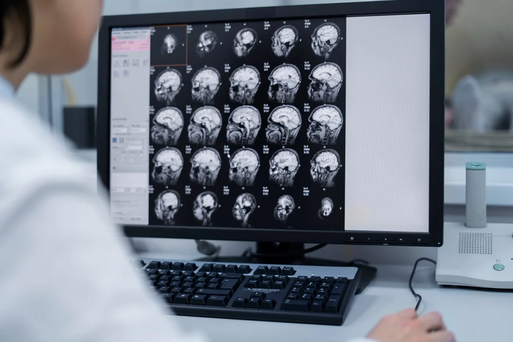 Upright MRI for Brain Scans
